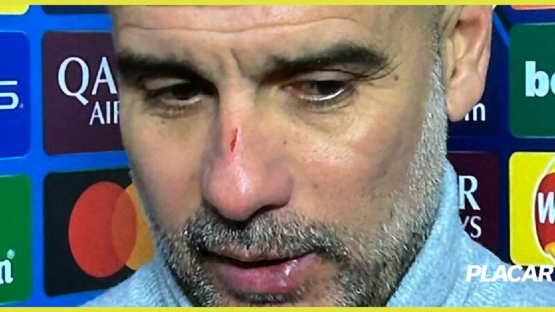 Guardiola explica arranhões após novo tropeço do City