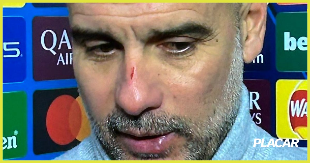 Guardiola explica arranhões após novo tropeço do City