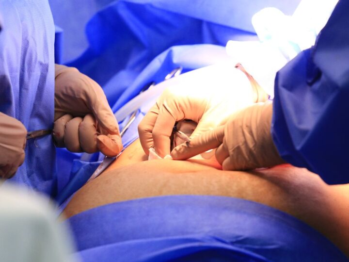 Ceará realiza cirurgia torácica robótica em paciente do SUS